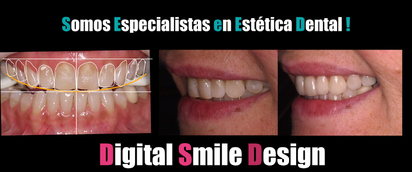 kinesiología dental