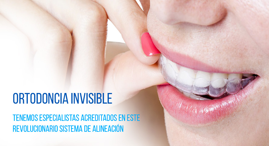ortodoncia invisible